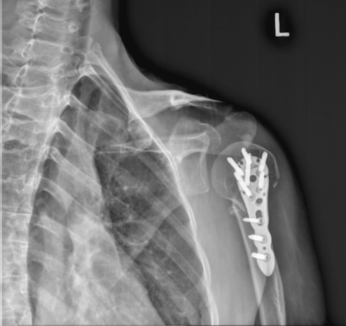 Cloud PACS Ortho