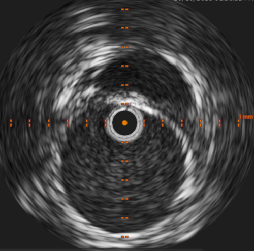Cloud PACS Vascular
